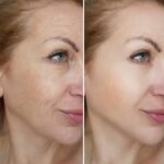 Osufi Serum 300ml, Osufi Collagen Face Serum - Image 5